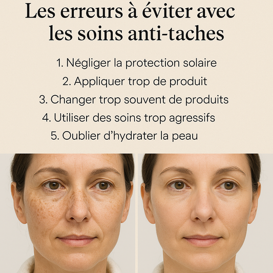Les erreurs à éviter avec les soins anti-taches